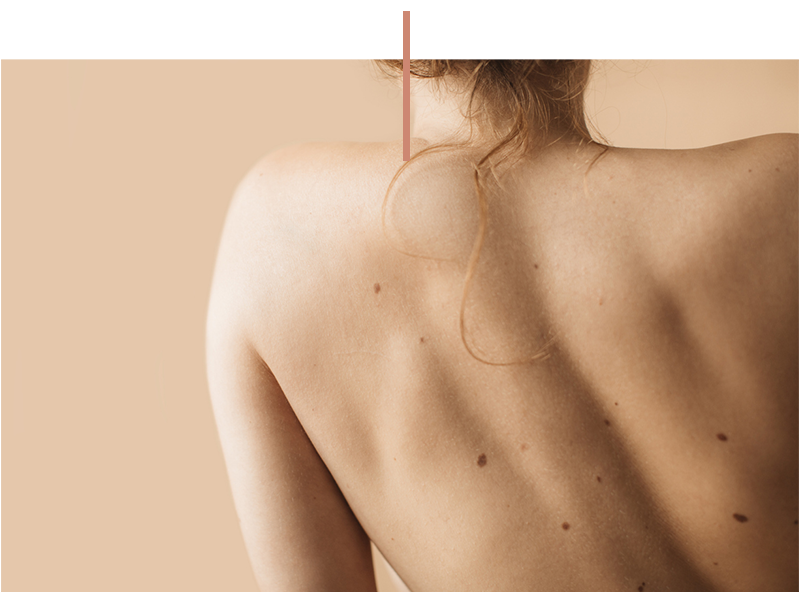 a person posing for the camera