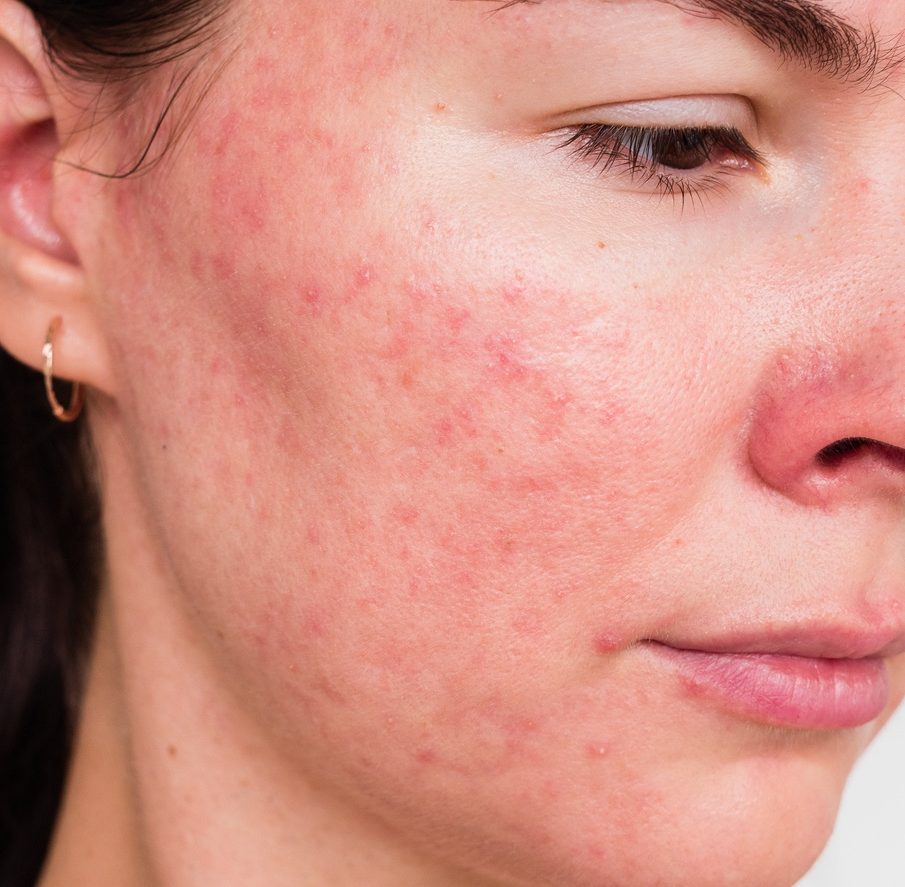 a close up of a woman