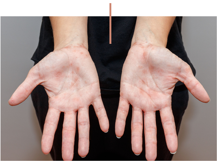 a close up of a hand