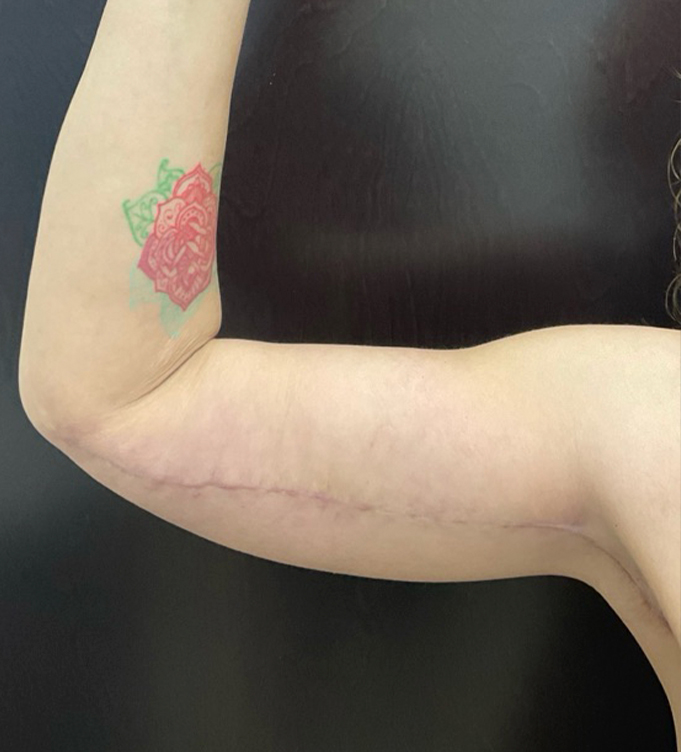 a tattoo on his head