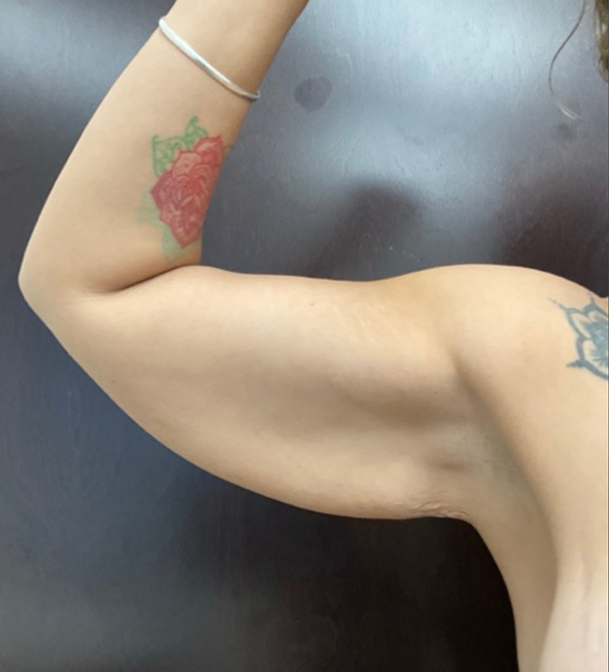 a woman wearing a dress