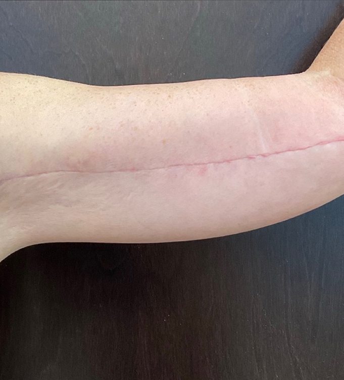 a close up of a hand